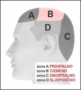 Zona ABCD CRO